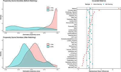 Switching From Proximal to Distal Radial Artery Access for Coronary Chronic Total Occlusion Recanalization